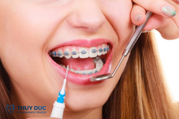 Đánh răng sai cách 1