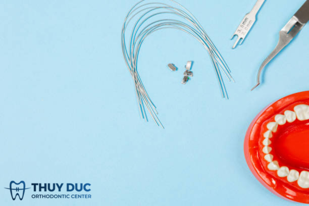 Vai trò của dây cung trong niềng răng 1 Vai trò của dây cung trong niềng răng 1