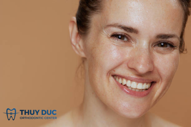 Niềng răng cho người 40 tuổi niềng mất bao lâu? 1