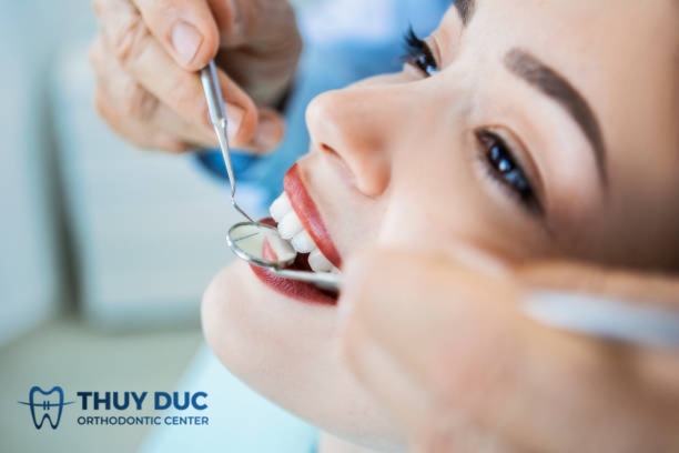 Sau khi niềng răng có nên tẩy trắng răng ngay không? 1 Sau khi niềng răng có nên tẩy trắng răng ngay không? 1