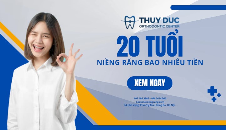 20 tuổi niềng răng bao nhiêu tiền? 1 20 tuổi niềng răng bao nhiêu tiền? 1