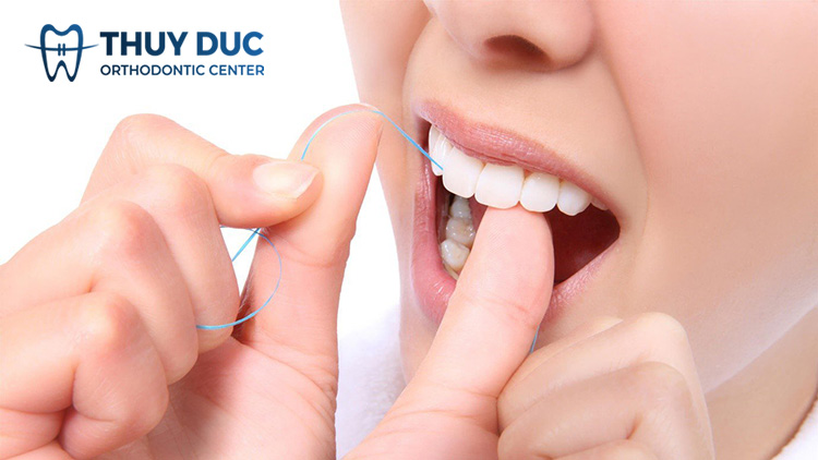 Chỉ nha khoa là gì? Có tác dụng gì? 1 Chỉ nha khoa là gì? Có tác dụng gì? 1