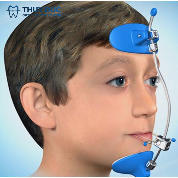 Dùng hàm facemask 1