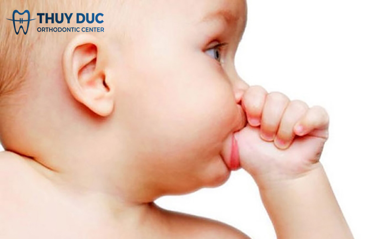 Nguyên nhân nào dẫn đến răng móm? 1