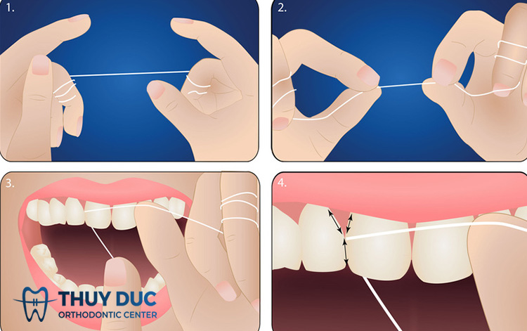 Cách dùng chỉ nha khoa cho người mới 1 Cách dùng chỉ nha khoa cho người mới 1