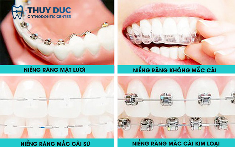 Một số câu hỏi thường gặp 2