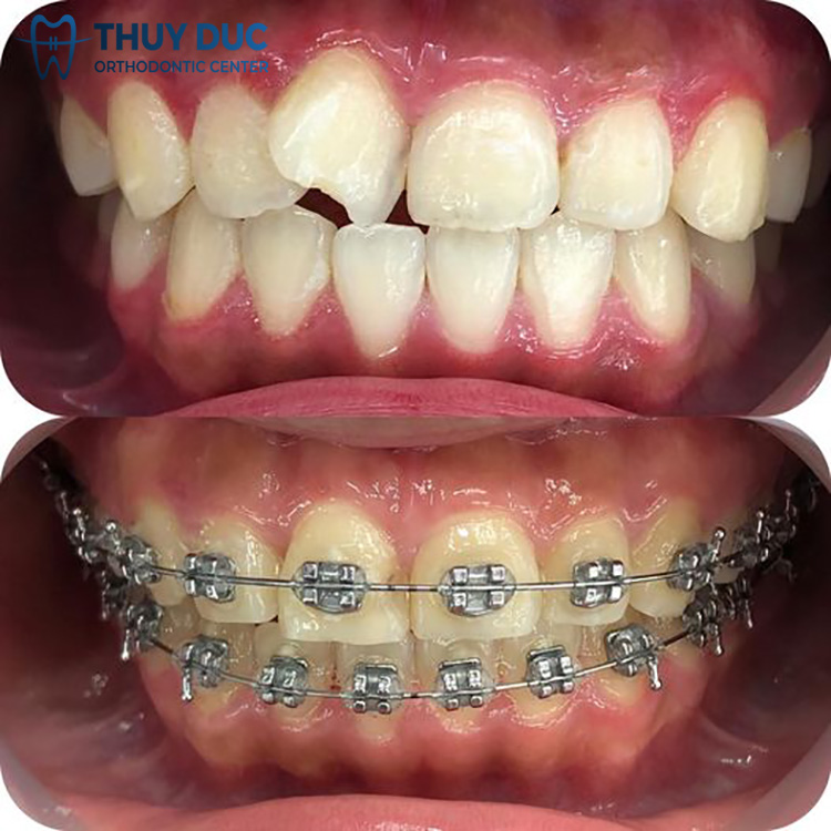 Một số câu hỏi thường gặp 1