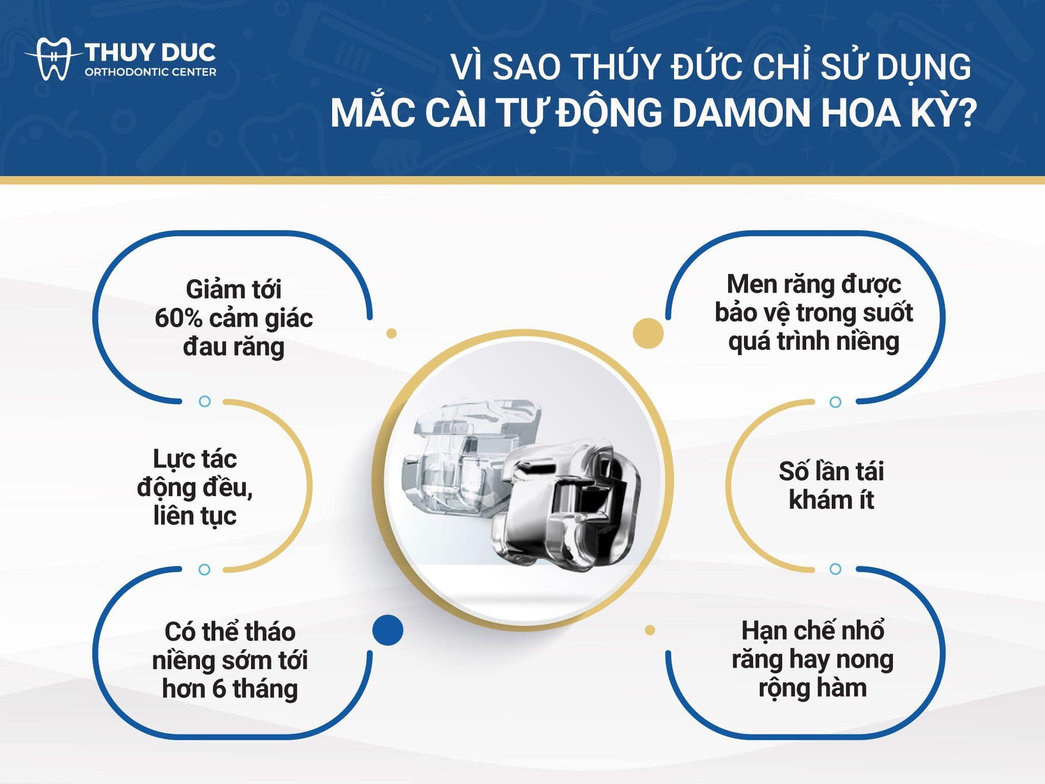 Phương pháp niềng 1 Phương pháp niềng 1