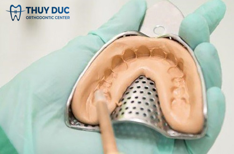 Lấy dấu răng bằng bột thạch cao/ bột lấy dấu răng 1 Lấy dấu răng bằng bột thạch cao/ bột lấy dấu răng 1