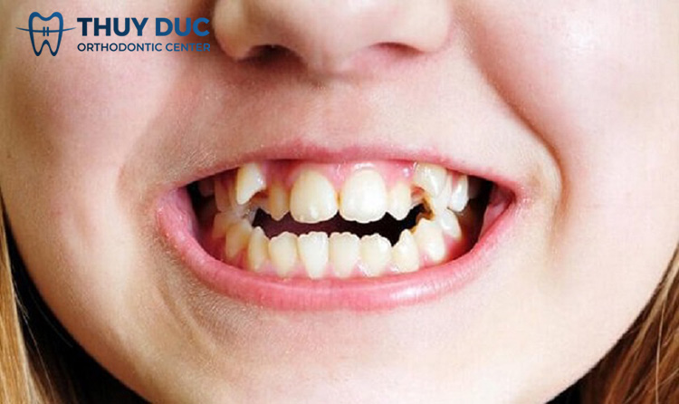 Ảnh hưởng đến thẩm mỹ 1 Ảnh hưởng đến thẩm mỹ 1