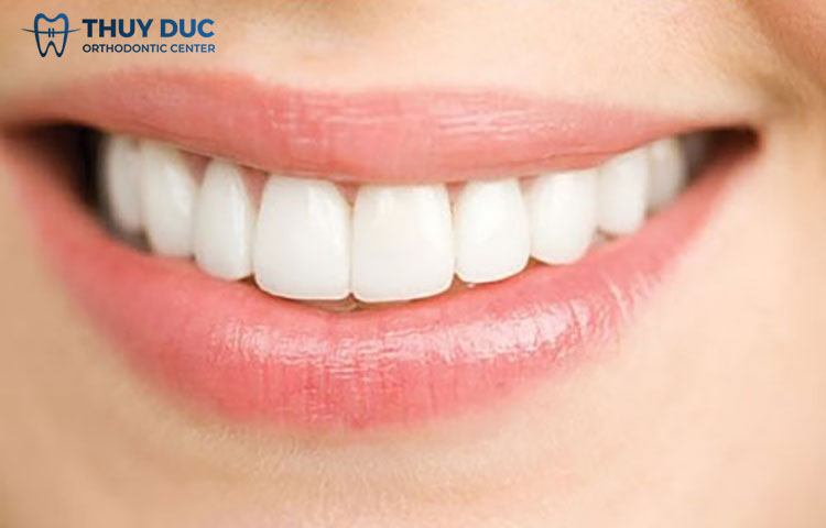 2.3. Răng rồng 1 2.3. Răng rồng 1