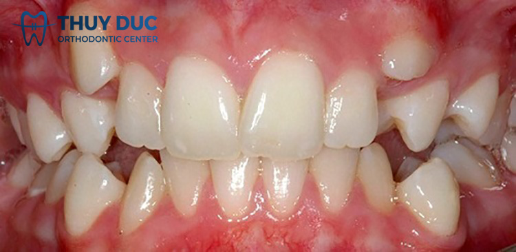 Gây mất thẩm mỹ 1