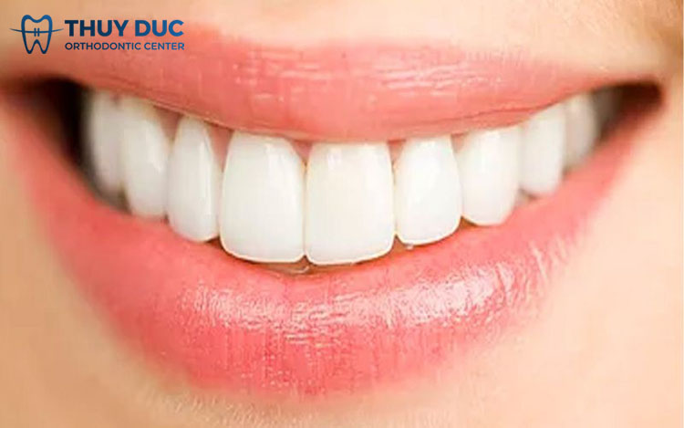 2.4. Răng trâu 1 2.4. Răng trâu 1