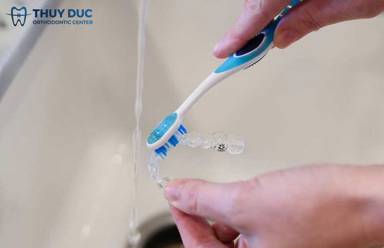 Cách bảo quản, vệ sinh hàm duy trì trong suốt 1