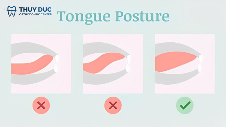 Mewing như thế nào cho hiệu quả? 1