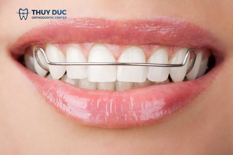 1.4. Giai đoạn 4: Duy trì ổn định 1 1.4. Giai đoạn 4: Duy trì ổn định 1