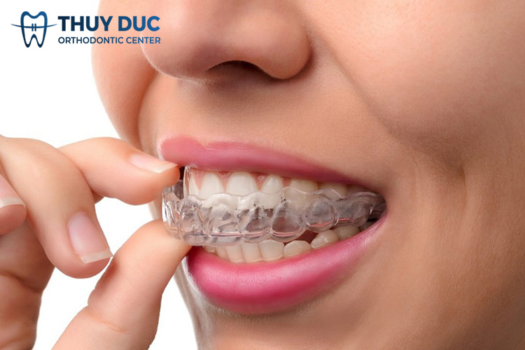 2. Câu hỏi thường gặp 2 2. Câu hỏi thường gặp 2