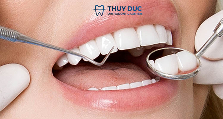 6. Cách khắc phục bọc răng sứ bị tụt nướu 1 6. Cách khắc phục bọc răng sứ bị tụt nướu 1