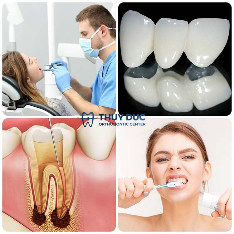 4. Nguyên nhân làm bọc răng sứ bị tụt nướu 1 4. Nguyên nhân làm bọc răng sứ bị tụt nướu 1