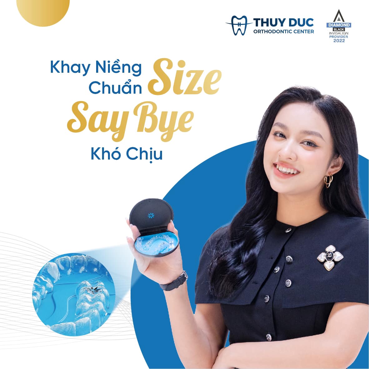 1.4. Trải nghiệm khi niềng 1