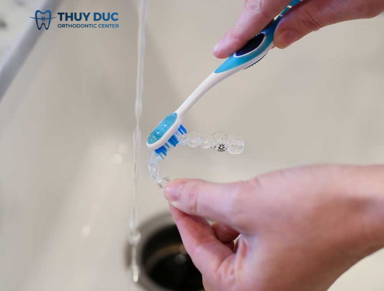 7. Niềng răng Invisalign - Xua tan nỗi lo mắc cài ố vàng 2 7. Niềng răng Invisalign - Xua tan nỗi lo mắc cài ố vàng 2