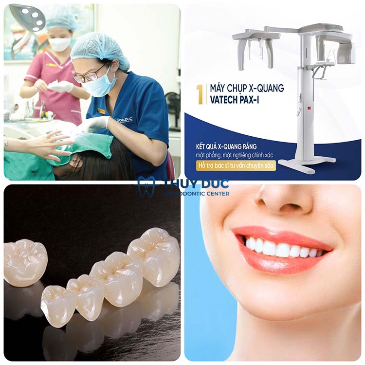 5. Nha khoa Thúy Đức - Địa chỉ bọc răng sứ uy tín, chất lượng 1 5. Nha khoa Thúy Đức - Địa chỉ bọc răng sứ uy tín, chất lượng 1