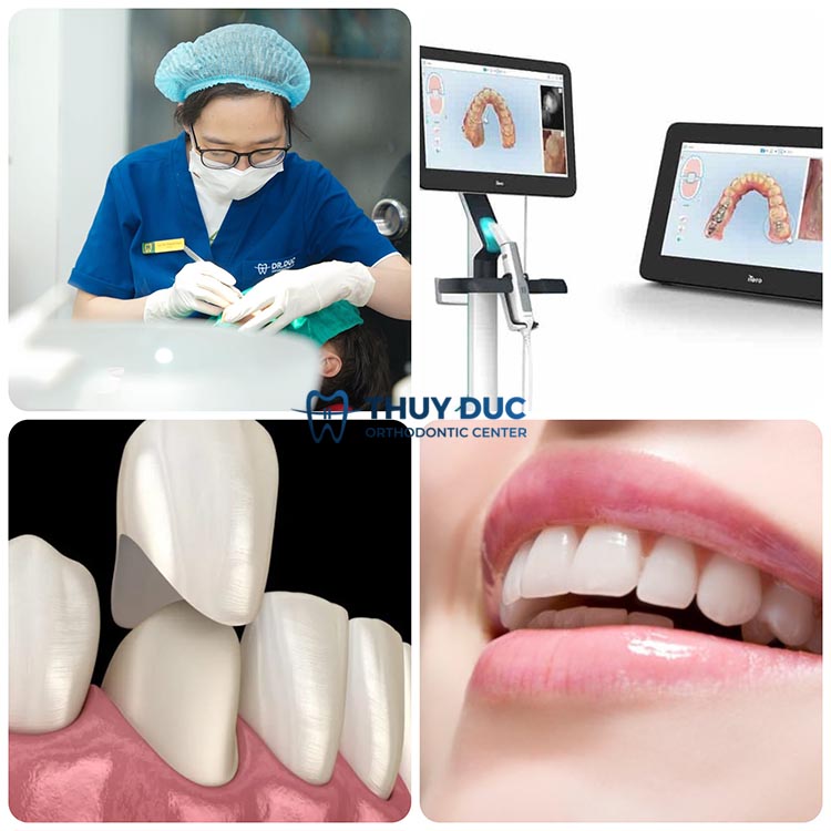 5. Nha Khoa Thúy Đức – Địa chỉ bọc răng sứ uy tín tại Hà Nội 1 5. Nha Khoa Thúy Đức – Địa chỉ bọc răng sứ uy tín tại Hà Nội 1