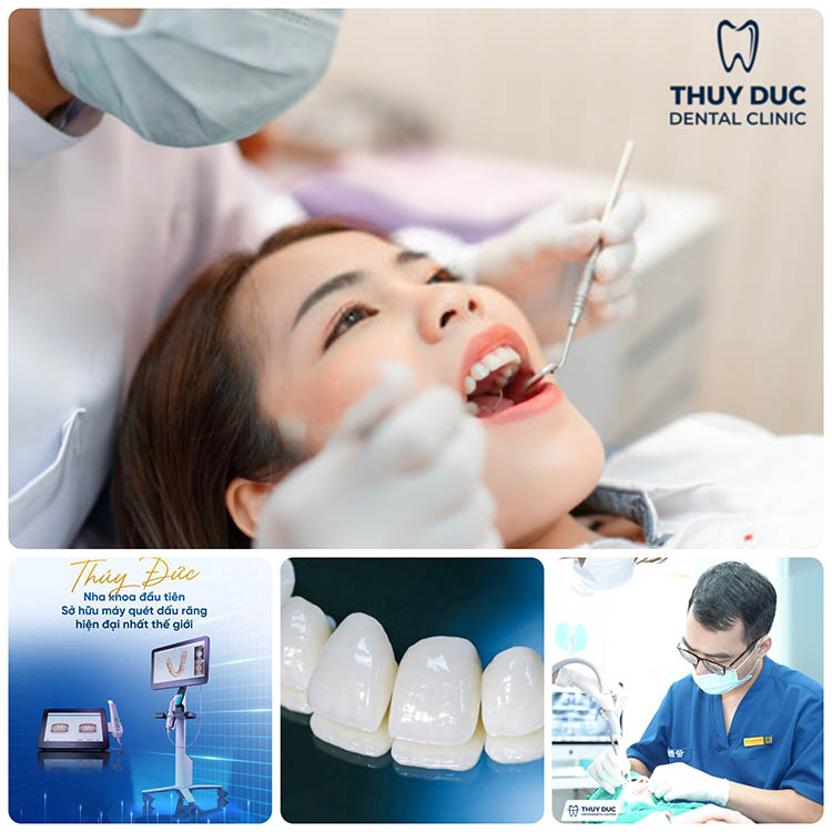 6. Địa chỉ bọc răng sứ uy tín, chất lượng 1