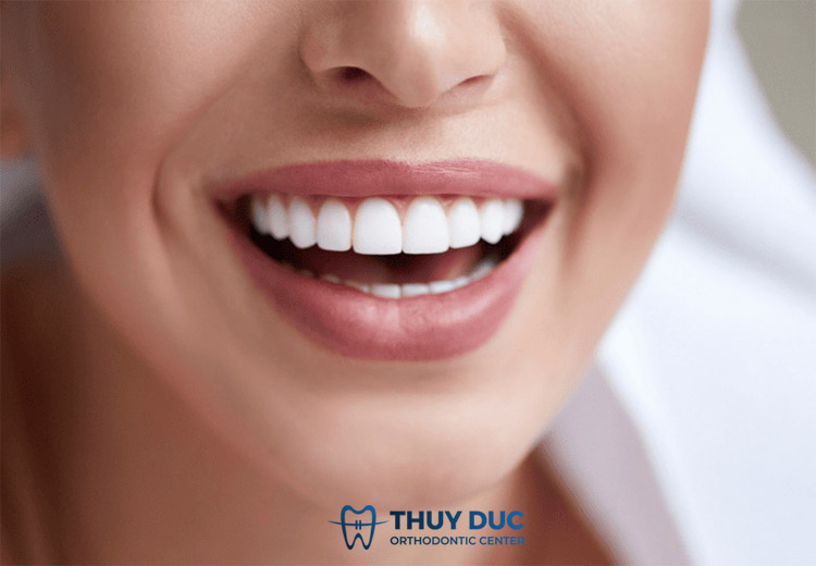 2. Răng toàn sứ có tốt không? 1 2. Răng toàn sứ có tốt không? 1