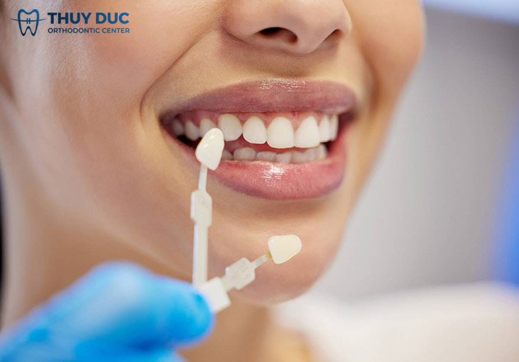 3. Ai nên và không nên bọc răng sứ không mài? 1