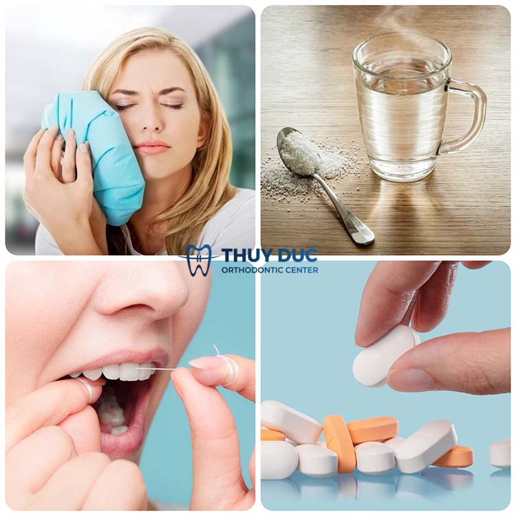 Nguyên nhân do đau nhức thông thường 1 Nguyên nhân do đau nhức thông thường 1