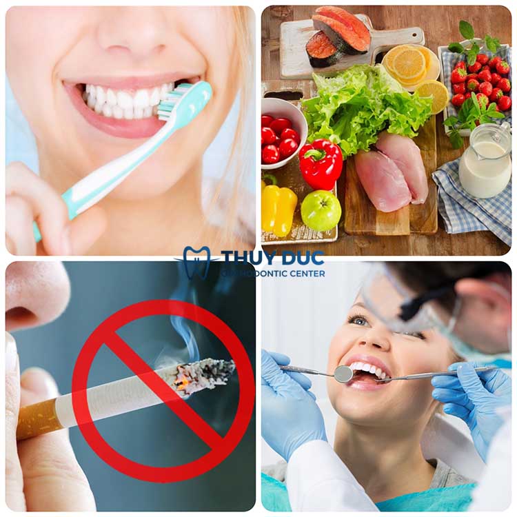 6. Hướng dẫn cách chăm sóc vệ sinh sau khi dán sứ 1