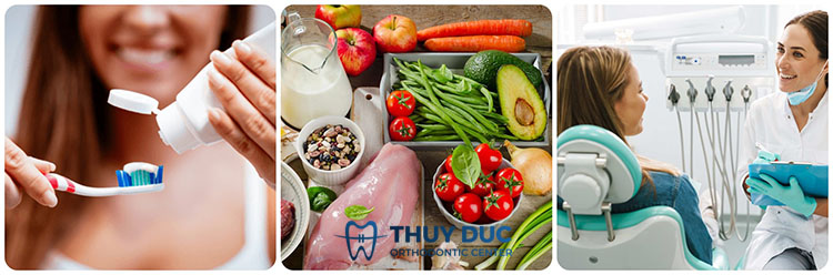 7. Lưu ý sau khi bọc răng sứ Titan 1 7. Lưu ý sau khi bọc răng sứ Titan 1