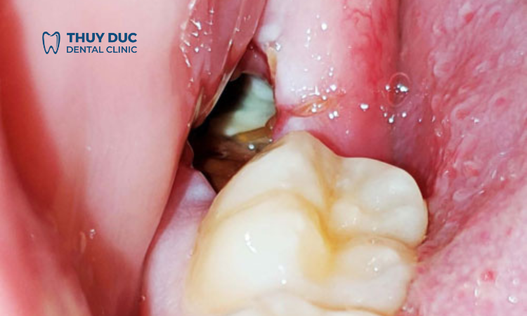 6. Khi nào thì cần liên hệ ngay với bác sĩ 1