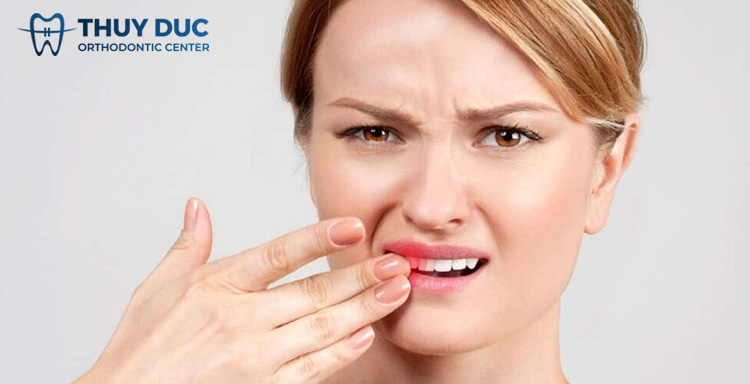 1. Các nguyên nhân khiến bọc răng sứ bị đau nhức 1 1. Các nguyên nhân khiến bọc răng sứ bị đau nhức 1