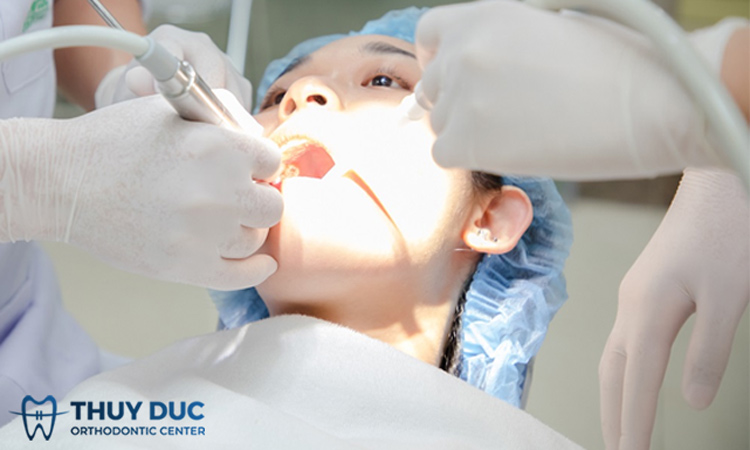 Nhổ răng khôn mọc ngầm sử dụng sóng siêu âm 1 Nhổ răng khôn mọc ngầm sử dụng sóng siêu âm 1