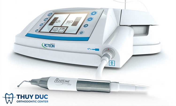 Ưu và nhược điểm khi nhổ răng khôn bằng máy siêu âm Piezotome 1 Ưu và nhược điểm khi nhổ răng khôn bằng máy siêu âm Piezotome 1