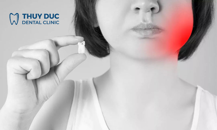 Nhổ răng khôn có bị sưng mặt không? 1