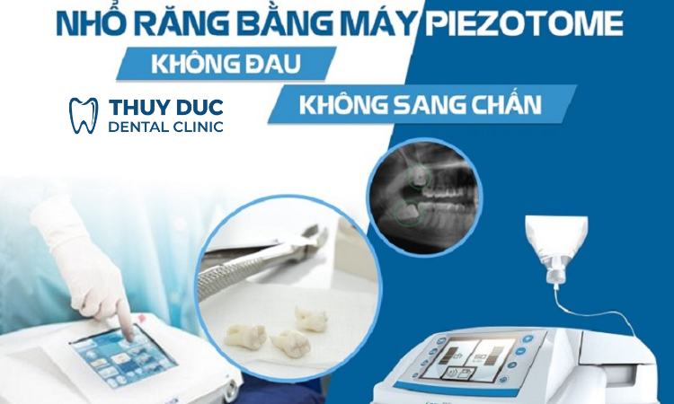Phụ thuộc vào công nghệ thực hiện 1 Phụ thuộc vào công nghệ thực hiện 1