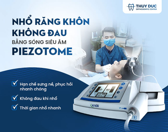 4. Những lưu ý trước khi nhổ răng khôn? 1