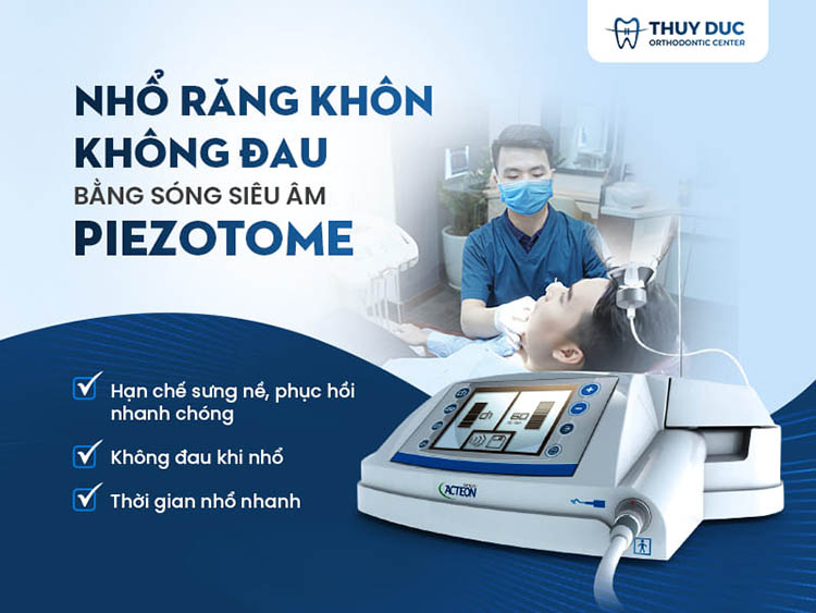Địa chỉ nhổ răng khôn an toàn, không đau tại Hà Nội 1 Địa chỉ nhổ răng khôn an toàn, không đau tại Hà Nội 1