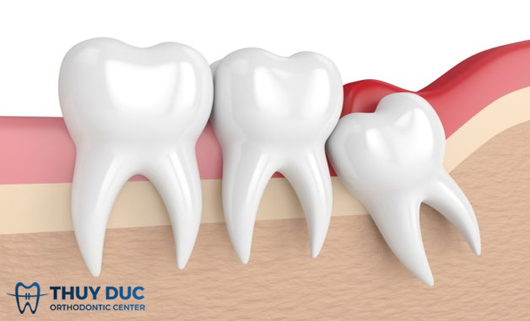 Những Lỗi Tư Duy Ảnh Hưởng Đến Quyết Định Hàng Ngày Của Bạn
