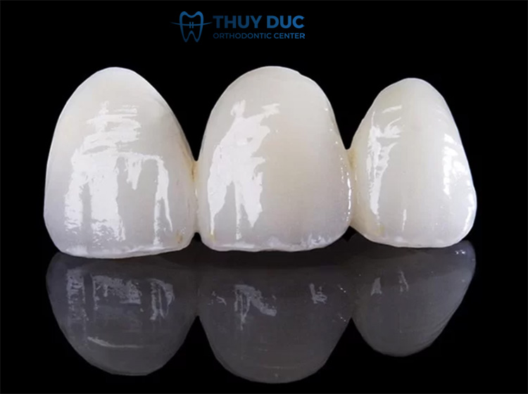 1. Răng toàn sứ là gì? 1 1. Răng toàn sứ là gì? 1