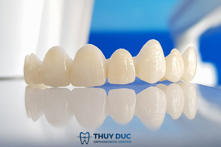 Răng toàn sứ 1 Răng toàn sứ 1