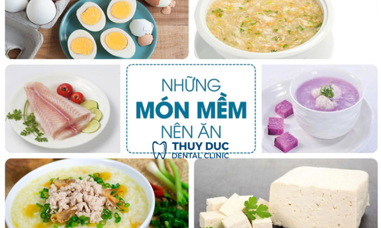 Cách chăm sóc sau khi nhổ răng khôn 1 Cách chăm sóc sau khi nhổ răng khôn 1