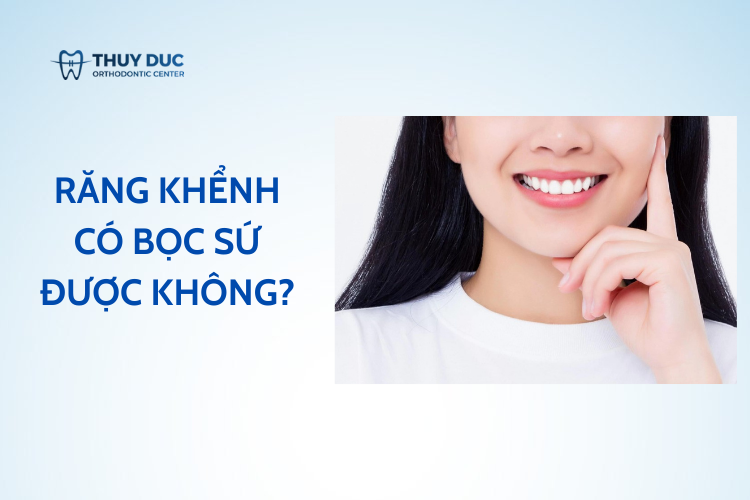 2. Răng khểnh có bọc sứ được không? 1