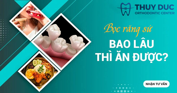 Bọc răng sứ bao lâu thì ăn được? 1