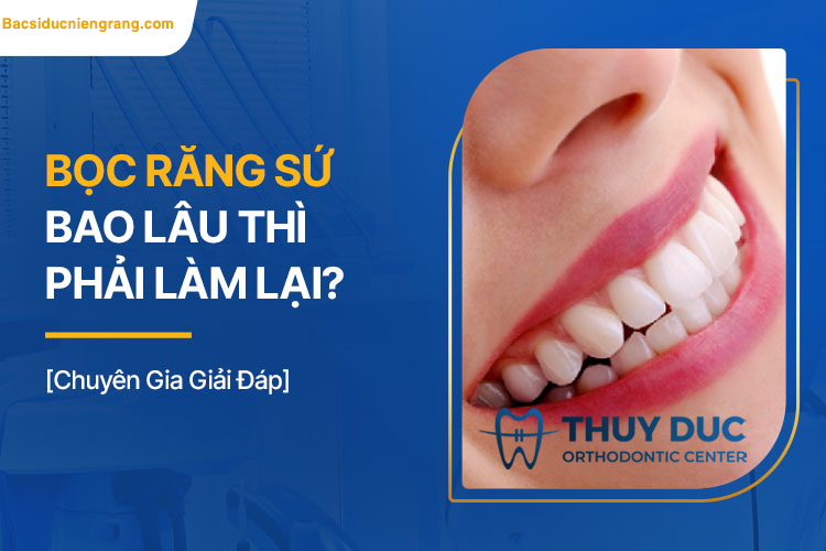 Bọc răng sứ bao lâu thì phải làm lại? 1