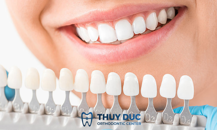 2. Bọc răng sứ có ảnh hưởng gì không? 1 2. Bọc răng sứ có ảnh hưởng gì không? 1