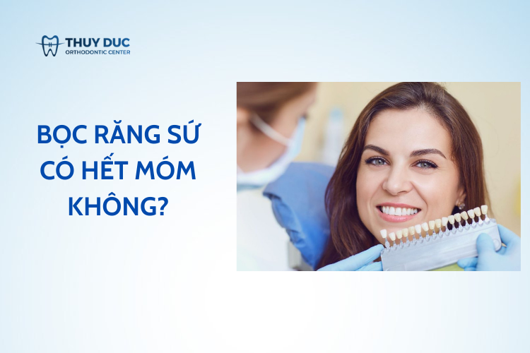 2. Bọc răng sứ có hết móm không? 1 2. Bọc răng sứ có hết móm không? 1